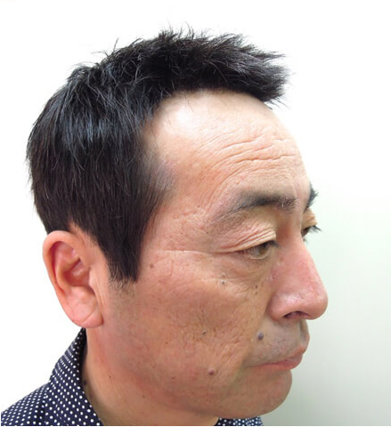 ベリーショートヘア|福岡・博多のかつら・増毛スタイル実例(グッドジョブヘア)