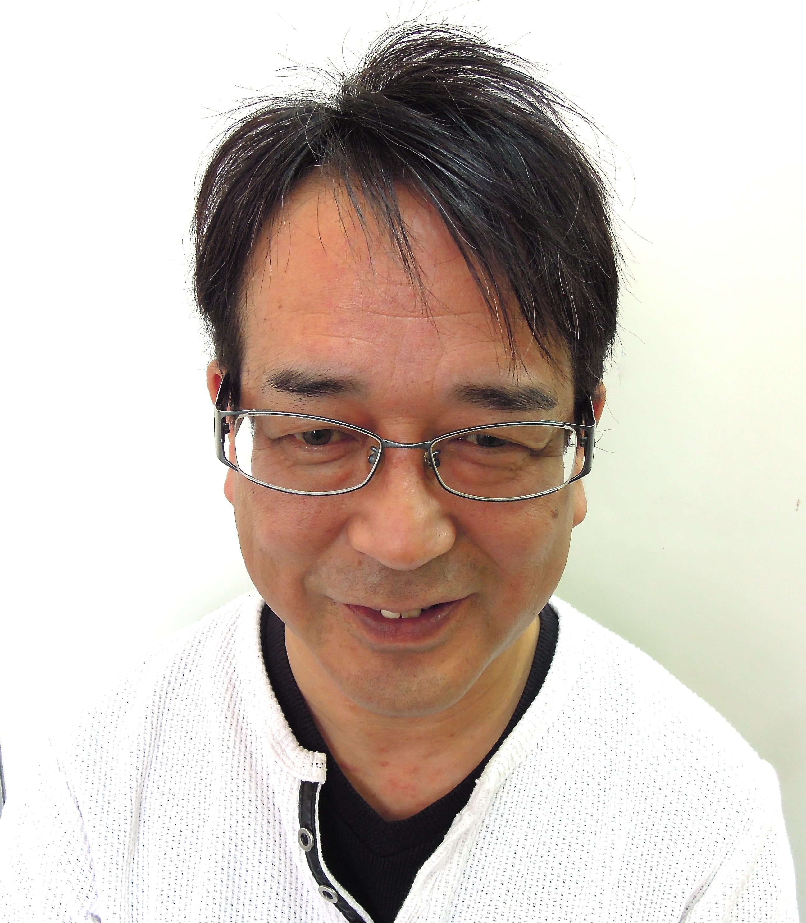 施術後:前髪ができて生え際が自然につながった黒髪のスタイル(正面)