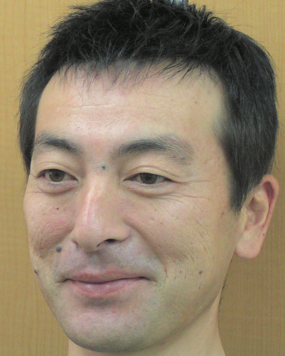 施術後:前髪のある黒髪のショートスタイルに仕上がった状態(正面)